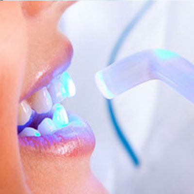 Laser Dentistry